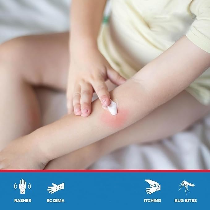 Pinewood Bite & Sting Relief Cream 10g – Hydrocortisone 1% Anti-Itch & Insect Bite Treatment