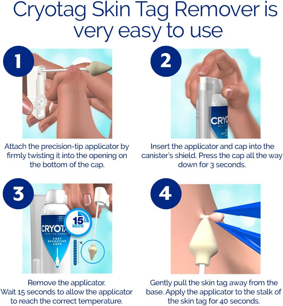 Cryotag Skin Tag Remover Fast Effective Safe Skin Tag Removal | Up to 12 treatments
