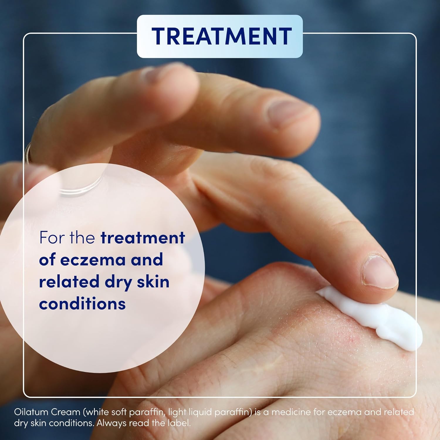 Oilatum Cream for Eczema, Psoriasis and Dry Skin Conditions 150g