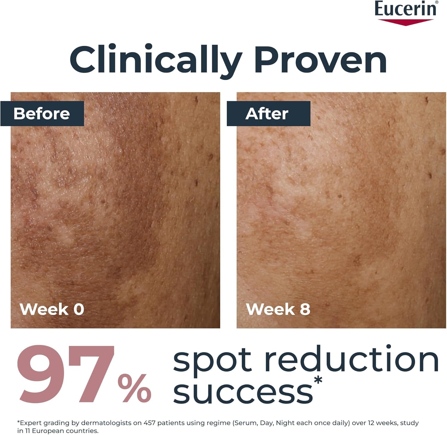 Eucerin Anti-Pigment Dual Serum 30ml – Reduce Age Spots & Uneven Skin Tone